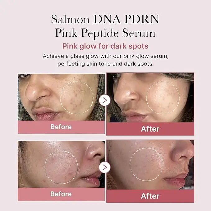 Medicube: Salmone Serum